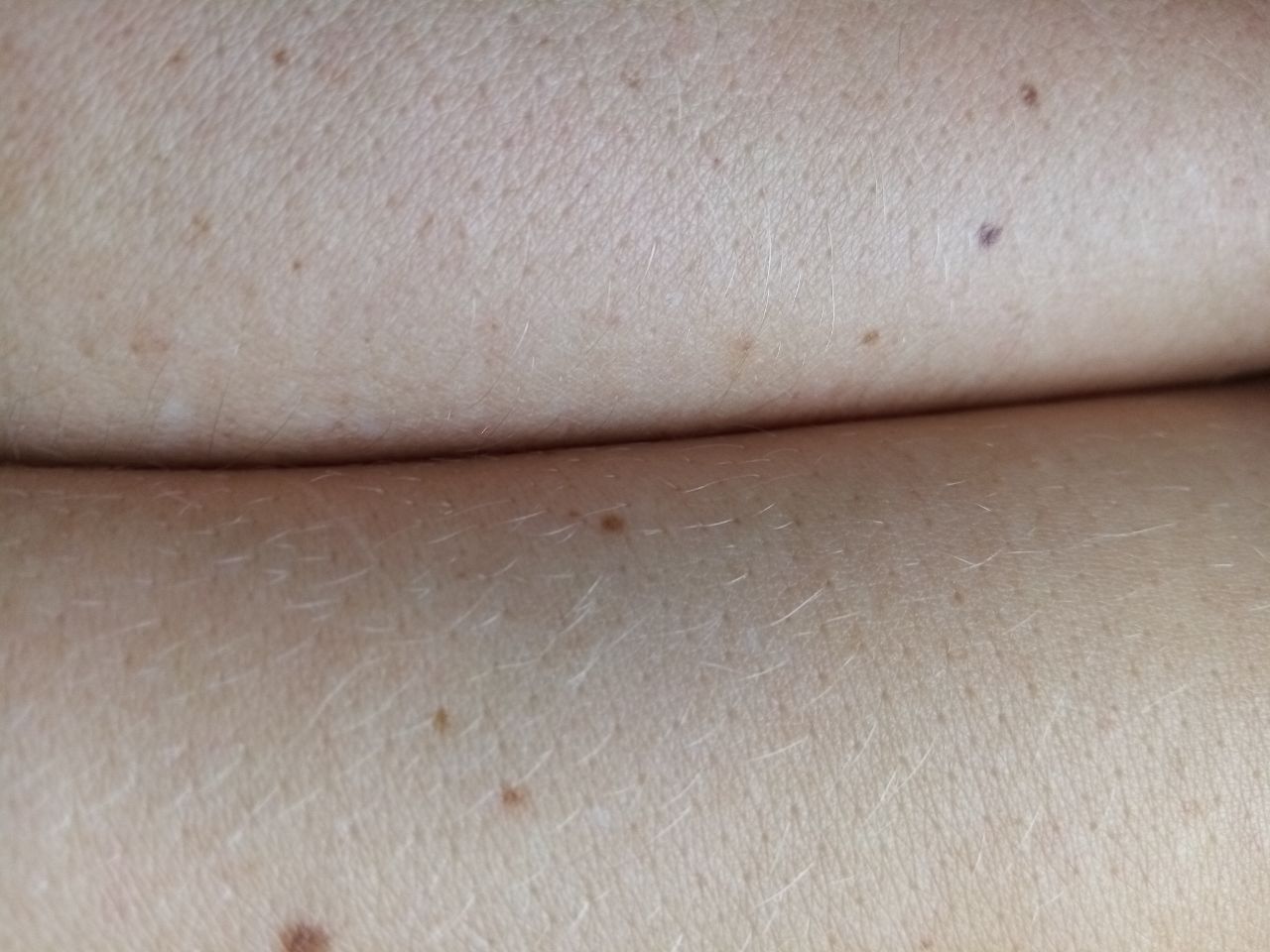 Goli oder: Bližje